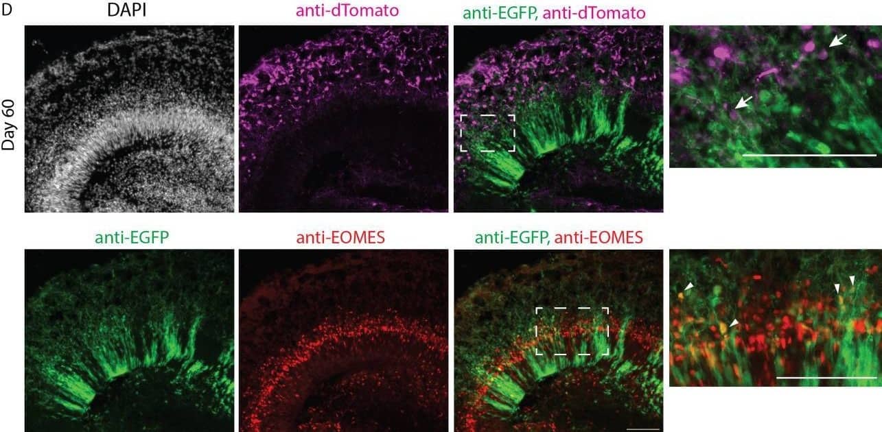 Immunohistochemistry EOMES Antibody