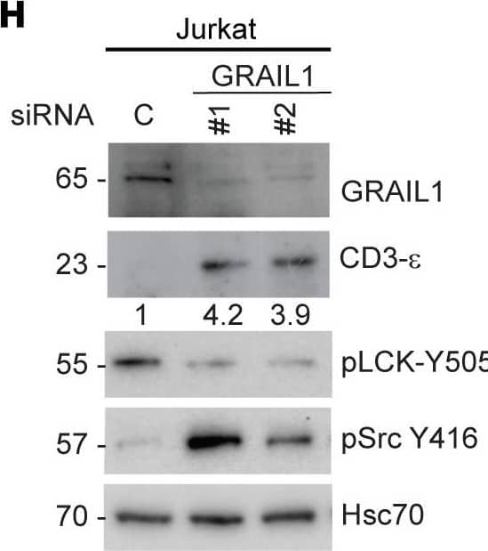 Western Blot GRAIL/RNF128 Antibody