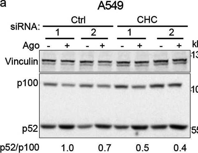 Clathrin and dynamin deficiency reduces activation of the non-canonical NF-kappa B pathway. a-c A549, HEK293T and CCD1070Sk cells were transfected with siRNAs targeting clathrin (CHC) (two oligonucleotides) along with control, non-targeting siRNAs (two oligonucleotides) and stimulated or not with Ago for 1 h. d, f A549 cells were transfected with siRNAs targeting dynamin-1/2 (three combinations of oligonucleotides targeting dynamin-1 and dynamin-2, see Methods) along with non-targeting control (Ctrl) siRNAs (two combinations of oligonucleotides, see Methods) and stimulated or not with Ago for 1 h. e, g A549 cells were treated with dynasore (DYN) or DMSO and stimulated or not with Ago for 1 h. Lysates of cells were analyzed by Western blotting with antibodies against the indicated proteins. Representative blots are shown. Values presented below blots represent the averaged p52/p100/loading control (a-e) or NIK/loading control ratio (f-g) from at least three experiments (normalized to the selected control, set as 1) in cells stimulated with Ago Image collected and cropped by CiteAb from the following open publication (//pubmed.ncbi.nlm.nih.gov/33148272), licensed under a CC-BY license. Not internally tested by R&D Systems.