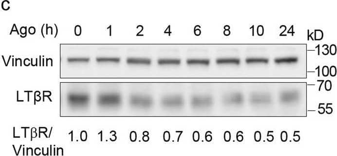LT beta R is internalized and trafficked towards degradation upon ligand binding. A549 cells were stimulated with Ago for the indicated time periods and immunostained for LT beta R, EEA1 and LAMP1 (a) or trans- (TGN46) and cis-Golgi (GM130) (b). Insets show magnified views of boxed regions in the main images. Scale bars, 20 μm. Graphs represent the analysis of colocalization between LT beta R and EEA1 or LAMP1, and integral intensity of LT beta R (a) and colocalization between LT beta R and GM130 or TGN46 (b). Data represent the means ± SEM, n ≥ 5 (a), n = 3 (b); ns - P > 0.05; *P ≤ 0.05; **P ≤ 0.01; ***P ≤ 0.001 by one sample t test. c Lysates of A549 cells stimulated with Ago for different time periods were analyzed by Western blotting with antibodies against LT beta R and vinculin (used as a loading control). Representative blots are shown. Values below blots represent the averaged LT beta R/vinculin ratio (n = 5) in cells stimulated with Ago for the indicated time periods. Values are normalized to unstimulated control (time 0) set as 1.d Lysates of A549, HEK293T, CCD1070Sk and HeLa cells pretreated or not for 20 h (A549, HEK293T, CCD1070Sk) or 16 h (HeLa) with lysosomal degradation inhibitor, chloroquine (CQ), stimulated or not with Ago for the next 4 h were analyzed by Western blotting with antibodies against LT beta R and GAPDH (used as a loading control). Representative blots are shown. Table presents the fold change of LT beta R abundance in stimulated vs unstimulated cells (means, n ≥ 3) Image collected and cropped by CiteAb from the following open publication (//pubmed.ncbi.nlm.nih.gov/33148272), licensed under a CC-BY license. Not internally tested by R&D Systems.