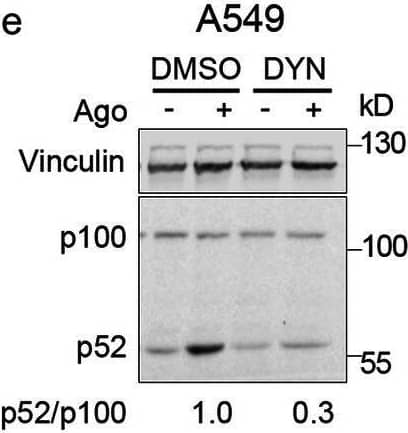 Clathrin and dynamin deficiency reduces activation of the non-canonical NF-kappa B pathway. a-c A549, HEK293T and CCD1070Sk cells were transfected with siRNAs targeting clathrin (CHC) (two oligonucleotides) along with control, non-targeting siRNAs (two oligonucleotides) and stimulated or not with Ago for 1 h. d, f A549 cells were transfected with siRNAs targeting dynamin-1/2 (three combinations of oligonucleotides targeting dynamin-1 and dynamin-2, see Methods) along with non-targeting control (Ctrl) siRNAs (two combinations of oligonucleotides, see Methods) and stimulated or not with Ago for 1 h. e, g A549 cells were treated with dynasore (DYN) or DMSO and stimulated or not with Ago for 1 h. Lysates of cells were analyzed by Western blotting with antibodies against the indicated proteins. Representative blots are shown. Values presented below blots represent the averaged p52/p100/loading control (a-e) or NIK/loading control ratio (f-g) from at least three experiments (normalized to the selected control, set as 1) in cells stimulated with Ago Image collected and cropped by CiteAb from the following open publication (//pubmed.ncbi.nlm.nih.gov/33148272), licensed under a CC-BY license. Not internally tested by R&D Systems.