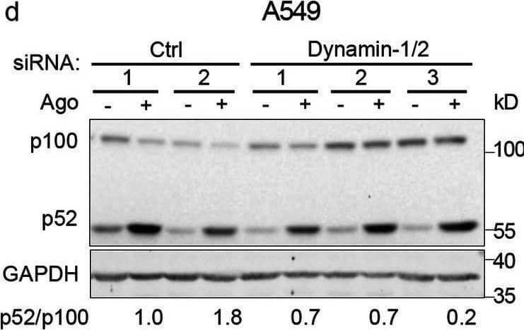 Clathrin and dynamin deficiency reduces activation of the non-canonical NF-kappa B pathway. a-c A549, HEK293T and CCD1070Sk cells were transfected with siRNAs targeting clathrin (CHC) (two oligonucleotides) along with control, non-targeting siRNAs (two oligonucleotides) and stimulated or not with Ago for 1 h. d, f A549 cells were transfected with siRNAs targeting dynamin-1/2 (three combinations of oligonucleotides targeting dynamin-1 and dynamin-2, see Methods) along with non-targeting control (Ctrl) siRNAs (two combinations of oligonucleotides, see Methods) and stimulated or not with Ago for 1 h. e, g A549 cells were treated with dynasore (DYN) or DMSO and stimulated or not with Ago for 1 h. Lysates of cells were analyzed by Western blotting with antibodies against the indicated proteins. Representative blots are shown. Values presented below blots represent the averaged p52/p100/loading control (a-e) or NIK/loading control ratio (f-g) from at least three experiments (normalized to the selected control, set as 1) in cells stimulated with Ago Image collected and cropped by CiteAb from the following open publication (//pubmed.ncbi.nlm.nih.gov/33148272), licensed under a CC-BY license. Not internally tested by R&D Systems.