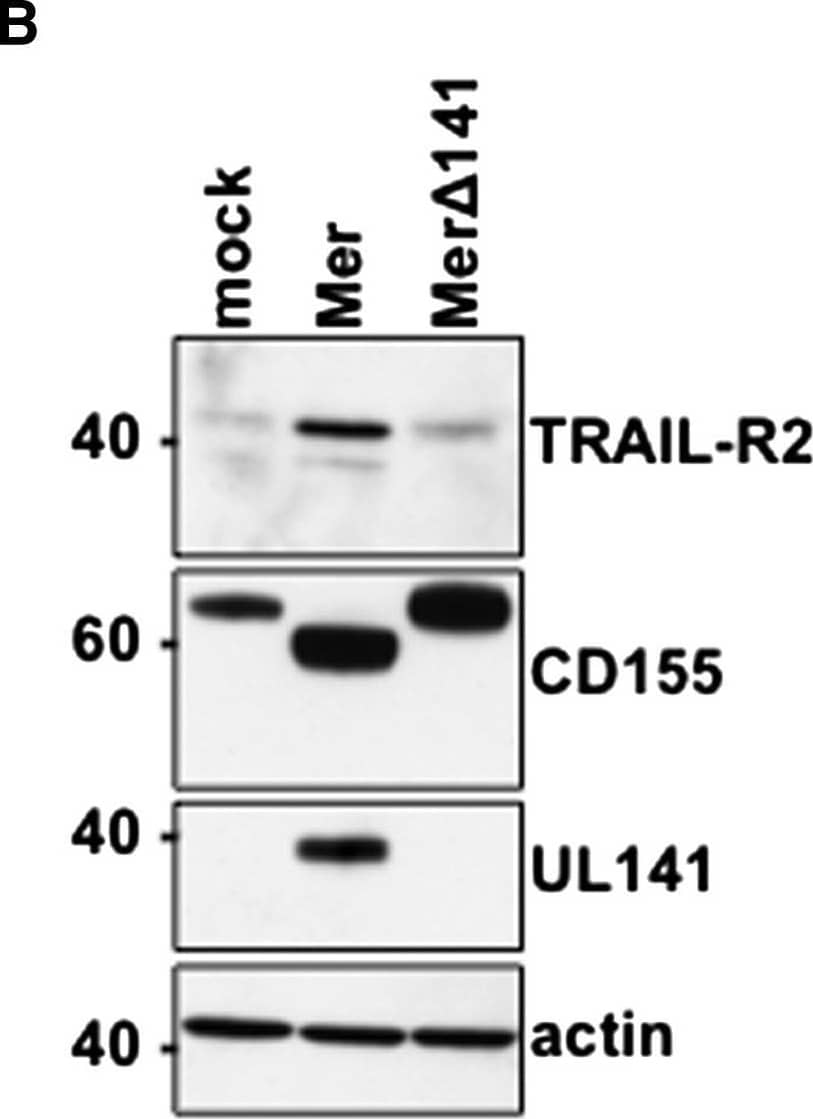TRAIL-R2 Expression in HCMV-Infected Cells Human foreskin fibroblasts (HFFs) were infected (72 hr, MOI = 20) with HCMV Merlin (Mer) or Merlin delta UL141 (Mer delta 141) and analyzed for TRAIL-R2 expression by (A) flow cytometry and (B) Western blot. IgG(–), isotype control antibody staining. Results are representative of six to ten performed experiments. See also Figure S2. Image collected and cropped by CiteAb from the following open publication (//pubmed.ncbi.nlm.nih.gov/23498957), licensed under a CC-BY license. Not internally tested by R&D Systems.