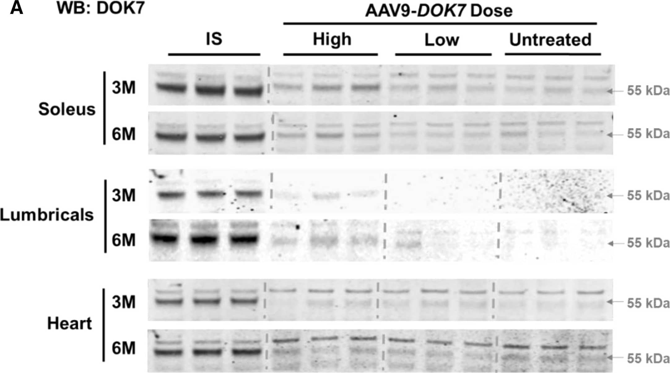 Western Blot DOK7 Antibody [Unconjugated]