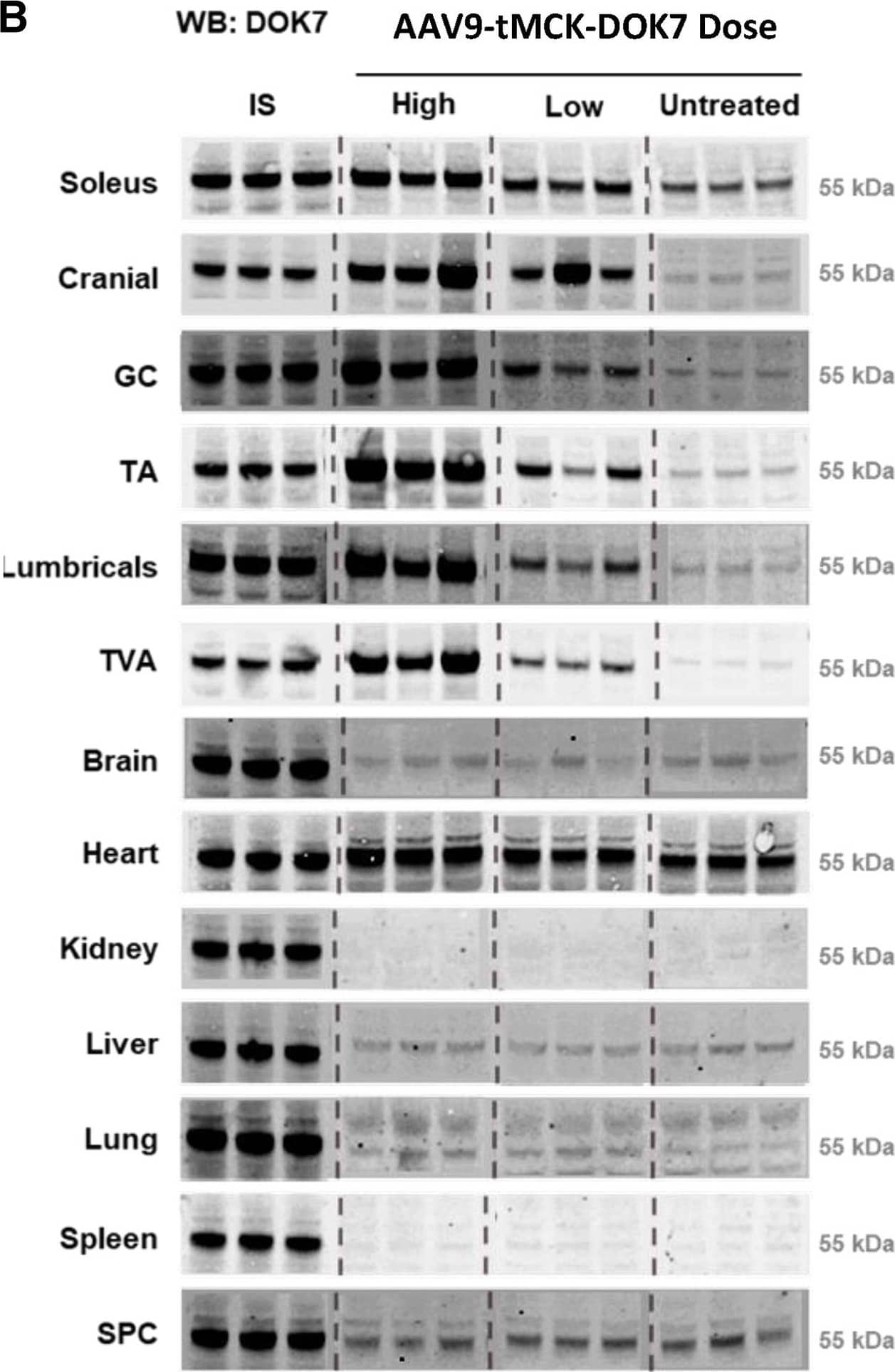 Western Blot DOK7 Antibody [Unconjugated]