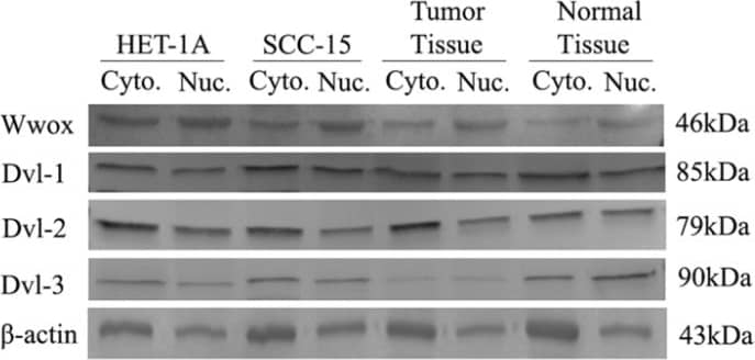 Intracellular distribution of Wwox, Dvl-1, Dvl-2 and Dvl-3 proteins in HET-1A and SCC-15 cell lines. Image collected and cropped by CiteAb from the following publication (//pubmed.ncbi.nlm.nih.gov/32368285), licensed under a CC-BY license. Not internally tested by R&D Systems.