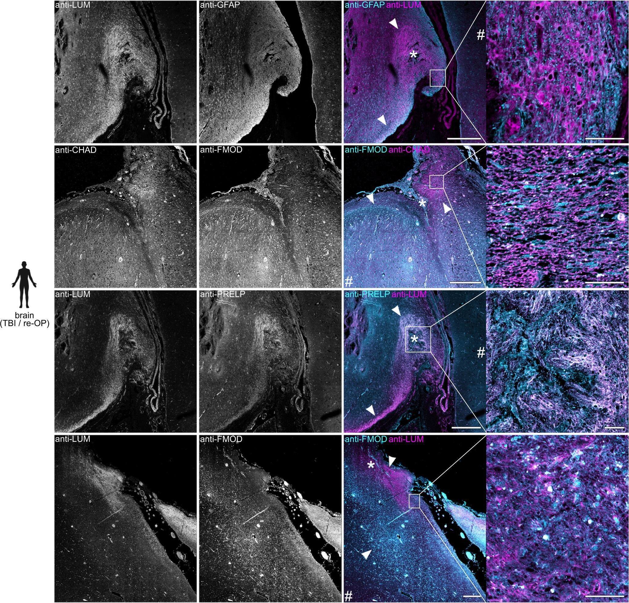Immunohistochemistry PRELP Antibody [Unconjugated]