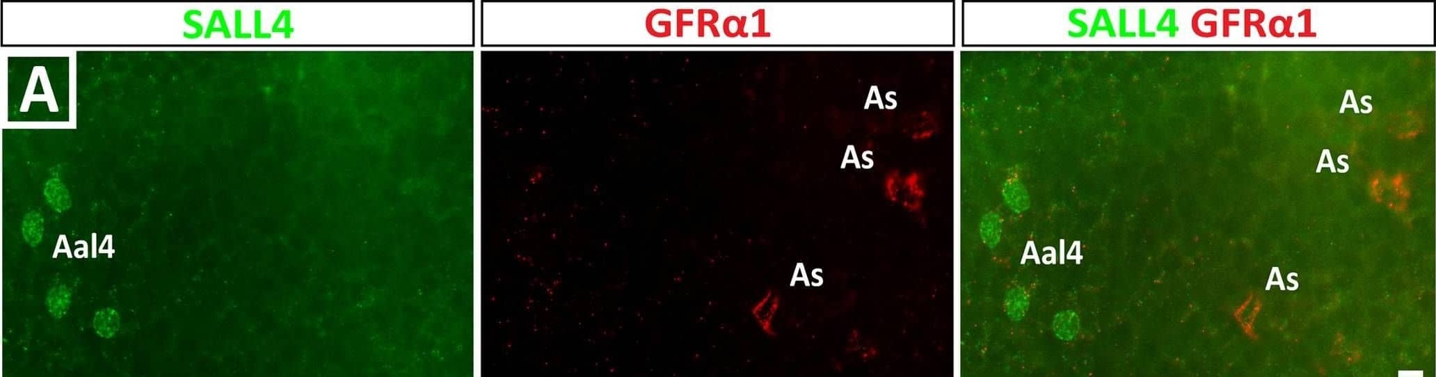 Immunohistochemistry TROP-2 Antibody [Unconjugated]