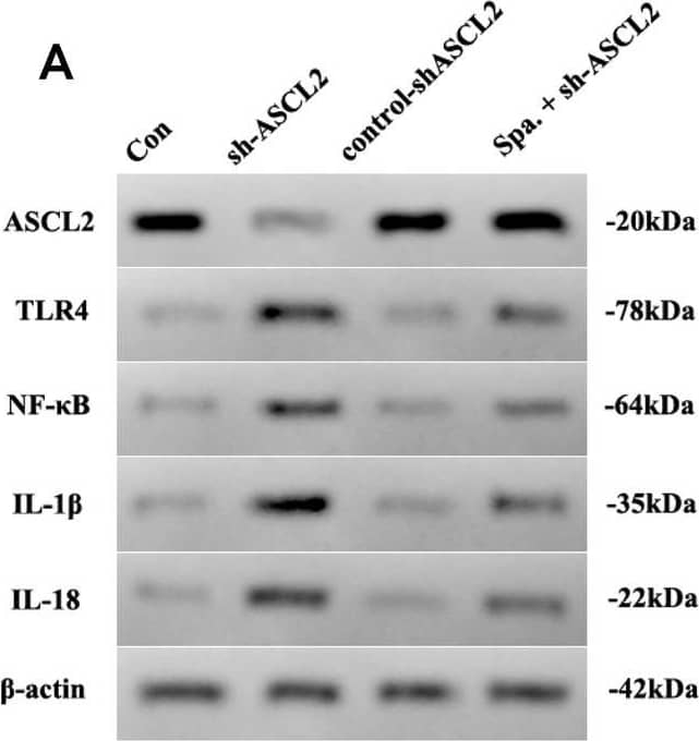 Western Blot ASCL2/Mash2 Antibody [Unconjugated]