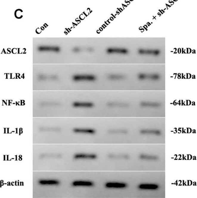 A ASCL2, TLR4, NF-kappa B, IL-1 beta , and IL-18 expressed in different groups, and B quantificated in vitro. C ASCL2, TLR4, NF-kappa B, IL-1 beta , and IL-18 expressed in different groups and D quantificated in vivo (sh-ASCL2 vs. Con, n = 6, *P < 0.05; Spa. + sh-ASCL2 vs. sh-ASCL2, n = 6,.#P < 0.05) Image collected and cropped by CiteAb from the following open publication (//pubmed.ncbi.nlm.nih.gov/36008864), licensed under a CC-BY license. Not internally tested by R&D Systems.