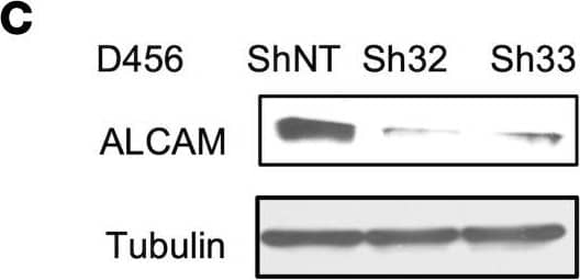 ST6GAL1 targeting decreases levels of a subset of N-glycoproteins that are known BTIC regulators.(A) Schematic of proteomic analysis of D456 BTICs with and without ST6GAL1 KD (n = 4 for each group of shNT, sh32, and sh33). IB with samples independent of the proteomic analysis verified that successful targeting ST6GAL1 resulted in decreased (B) PDGFRB, (C) ALCAM, and (D) NRP1 protein. (E) Schematic of pulldown using SNA-bound Agarose beads. (F) SNA pulldown and protein A/G bound agarose beads as a control demonstrated that PDGFRB, ALCAM, and NRP1 were targets for  alpha 2,6 sialylation. (G) SNA pulldown of D456 PDX cells with ST6GAL1 KD compared with NT, illustrating differential pulldown of PDGFRB. (H) PDGF-BB–induced (10 minutes) activation of PDGFRB in D456 GBM PDX cells with ST6GAL1 KD compared with NT; IB for p-PDGFRB and total PDGFRB. The experiments were repeated in at least 3 independent biological replicates. Data from 1 representative experiment are shown. Image collected and cropped by CiteAb from the following open publication (//pubmed.ncbi.nlm.nih.gov/36345944), licensed under a CC-BY license. Not internally tested by R&D Systems.