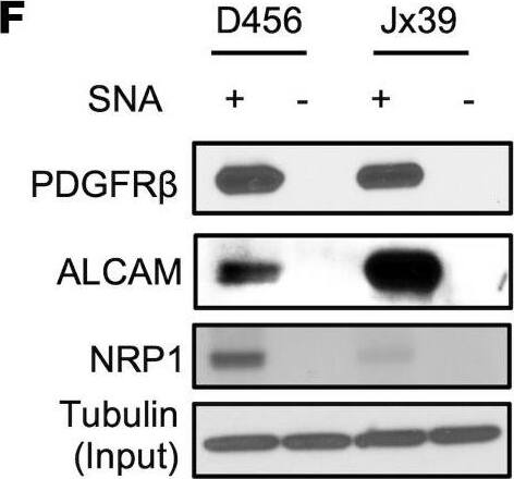 ST6GAL1 targeting decreases levels of a subset of N-glycoproteins that are known BTIC regulators.(A) Schematic of proteomic analysis of D456 BTICs with and without ST6GAL1 KD (n = 4 for each group of shNT, sh32, and sh33). IB with samples independent of the proteomic analysis verified that successful targeting ST6GAL1 resulted in decreased (B) PDGFRB, (C) ALCAM, and (D) NRP1 protein. (E) Schematic of pulldown using SNA-bound Agarose beads. (F) SNA pulldown and protein A/G bound agarose beads as a control demonstrated that PDGFRB, ALCAM, and NRP1 were targets for  alpha 2,6 sialylation. (G) SNA pulldown of D456 PDX cells with ST6GAL1 KD compared with NT, illustrating differential pulldown of PDGFRB. (H) PDGF-BB–induced (10 minutes) activation of PDGFRB in D456 GBM PDX cells with ST6GAL1 KD compared with NT; IB for p-PDGFRB and total PDGFRB. The experiments were repeated in at least 3 independent biological replicates. Data from 1 representative experiment are shown. Image collected and cropped by CiteAb from the following open publication (//pubmed.ncbi.nlm.nih.gov/36345944), licensed under a CC-BY license. Not internally tested by R&D Systems.