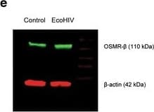 Western Blot OSMR beta Antibody