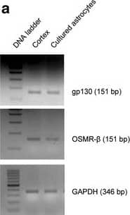 Western Blot OSMR beta Antibody