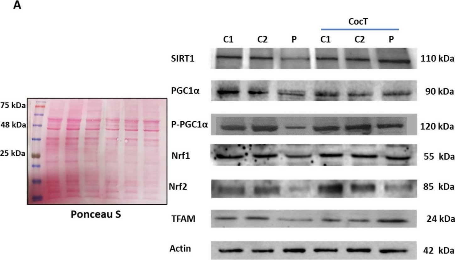Western Blot PGC1 alpha [p Ser571] Antibody [Unconjugated]