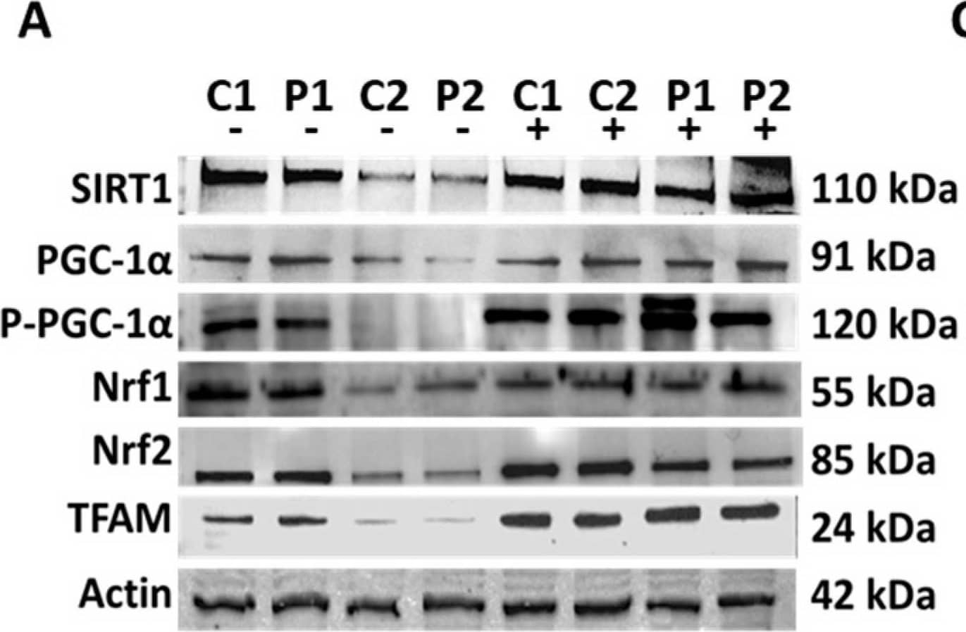 Western Blot PGC1 alpha [p Ser571] Antibody [Unconjugated]