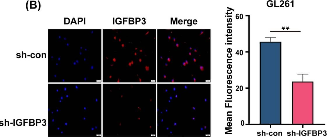 Targeting IGFBP3 therapy efficiently suppresses glioblastoma invasion in vitro and tumor growth in vivo via reducing PD-L1 expression. A Immunoblotting analysis of IGFBP3 expression in GL261 cell infected with sh-IGFBP3 and sh-con. B Immunofluorescence was used to examine IGFBP3 expression in GL261 cell infected with sh-IGFBP3 and sh-con. C Left: Representative image of brain orthotopic tumor. Right: HE stained representative image of brain tumor section. D Kaplan–Meier plots for GL261-shcon and GL261-shIGFBP3 groups, and statistical significance was assessed using the log-rank test. E Immunohistochemical representative images of IGFBP3, PD-L1 and CD31 in the GL261-shcon and GL261-shIGFBP3 groups. F IGFBP3 up-regulates the expression of PD-L1 by activating JAK2/STAT3 signaling pathway. PD-L1 binds to T cell–derived PD-1 to promote T cell apoptosis and immunosuppression. Data are expressed as mean ± SD. **P < 0.01; ***P < 0.001, Student t test Image collected and cropped by CiteAb from the following open publication (//cancerci.biomedcentral.com/articles/10.1186/s12935-024-03234-3), licensed under a CC-BY license. Not internally tested by R&D Systems.