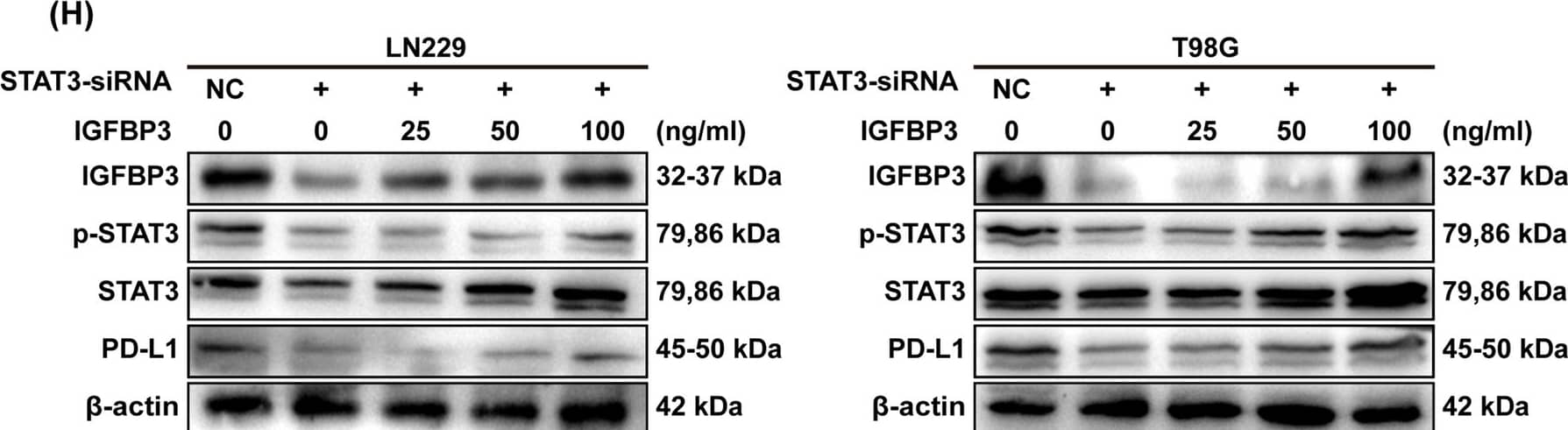 IGFBP3 increases PD-L1 expression by up-regulating the phosphorylation of STAT3 in GBM cells. A KEGG analysis of differential genes. B Correlation analysis of IGFBP3 and STAT3 in TCGA and CGGA databases, and statistical significance was assessed using the spearman’s rank test. C Immunoblotting analysis of IGFBP3, p-JAK2, p-STAT3, and PD-L1 expression in U251 cell treated with different concentrations of IGFBP3 for 24 h. D Immunoblotting analysis of IGFBP3, p-JAK2, p-STAT3, and PD-L1 expression in U251 cells infected with IGFBP3 overexpressing and empty vector lentivirus. E Immunoblotting was performed to examine the expression of IGFBP3, p-JAK2, p-STAT3, and PD-L1 in LN229 cell transfected with si-IGFBP3 and si-NC. F Immunoblotting analysis of IGFBP3, p-JAK2, p-STAT3, and PD-L1 expression in LN229 cell infected with sh-IGFBP3 and sh-con. G LN229 and T98G cells with IGFBP3 knockdown were treated with the JAK2/STAT3 inhibitor WP1066 for 24 h, cell lysate was used to analyze the expression of p-JAK2, p-STAT3 and PD-L1. H Immunoblotting was used to analyze the expression of IGFBP3, p-STAT3, and PD-L1 in STAT3-silenced LN229 and T98G cells stimulated with different concentrations of exogenous IGFBP3 for 24 h Image collected and cropped by CiteAb from the following open publication (//cancerci.biomedcentral.com/articles/10.1186/s12935-024-03234-3), licensed under a CC-BY license. Not internally tested by R&D Systems.