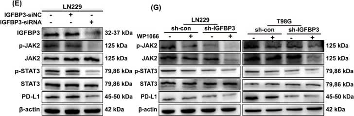 IGFBP3 increases PD-L1 expression by up-regulating the phosphorylation of STAT3 in GBM cells. A KEGG analysis of differential genes. B Correlation analysis of IGFBP3 and STAT3 in TCGA and CGGA databases, and statistical significance was assessed using the spearman’s rank test. C Immunoblotting analysis of IGFBP3, p-JAK2, p-STAT3, and PD-L1 expression in U251 cell treated with different concentrations of IGFBP3 for 24 h. D Immunoblotting analysis of IGFBP3, p-JAK2, p-STAT3, and PD-L1 expression in U251 cells infected with IGFBP3 overexpressing and empty vector lentivirus. E Immunoblotting was performed to examine the expression of IGFBP3, p-JAK2, p-STAT3, and PD-L1 in LN229 cell transfected with si-IGFBP3 and si-NC. F Immunoblotting analysis of IGFBP3, p-JAK2, p-STAT3, and PD-L1 expression in LN229 cell infected with sh-IGFBP3 and sh-con. G LN229 and T98G cells with IGFBP3 knockdown were treated with the JAK2/STAT3 inhibitor WP1066 for 24 h, cell lysate was used to analyze the expression of p-JAK2, p-STAT3 and PD-L1. H Immunoblotting was used to analyze the expression of IGFBP3, p-STAT3, and PD-L1 in STAT3-silenced LN229 and T98G cells stimulated with different concentrations of exogenous IGFBP3 for 24 h Image collected and cropped by CiteAb from the following open publication (//cancerci.biomedcentral.com/articles/10.1186/s12935-024-03234-3), licensed under a CC-BY license. Not internally tested by R&D Systems.