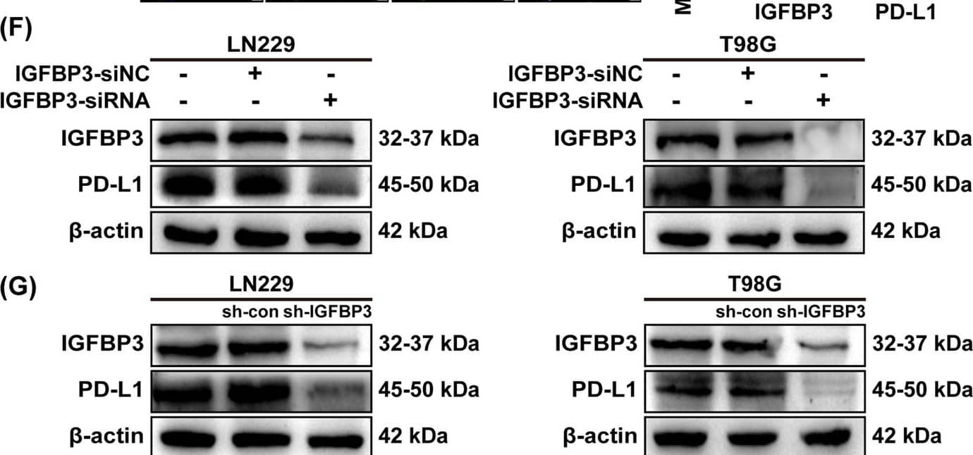 IGFBP3 transcriptionally regulates PD-L1 expression in GBM cells. A Immunoblotting analysis of IGFBP3 and PD-L1 expression in U251 and U118 cells treated with different concentrations of exogenous IGFBP3 (0, 25, 50, and 100 ng/mL) for 24 h. B Immunoblotting was performed to determine the expression of IGFBP3 and PD-L1 in U251 and U118 cells stimulated with 100 ng/mL of IGFBP3 for 0, 12, 24, and 48 h. C QRT-PCR analysis of IGFBP3 and PD-L1 mRNA expression levels in U251 and U118 cells infected with overexpressing IGFBP3 and empty vector lentivirus. D Immunoblotting assay of IGFBP3 and PD-L1 protein expression in U251 and U118 cells infected with overexpressing IGFBP3 and empty vector lentivirus. E Representative immunofluorescence images of DAPI (blue), IGFBP3 (red), PD-L1 (green) in U251-vector and U251-IGFBP3 cells. F Immunoblotting was performed to examine the expression of IGFBP3 and PD-L1 in LN229 and T98G cells transfected with si-RNA targeting IGFBP3 (si-IGFBP3) and negative control (si-NC). G Immunoblotting analysis of IGFBP3 and PD-L1 expression in LN229 and T98G cells infected with lentivirus of targeting IGFBP3 (sh-IGFBP3) and control (sh-con). Data are expressed as mean ± SD. **P < 0.01; ***P < 0.001, Student t test Image collected and cropped by CiteAb from the following open publication (//cancerci.biomedcentral.com/articles/10.1186/s12935-024-03234-3), licensed under a CC-BY license. Not internally tested by R&D Systems.
