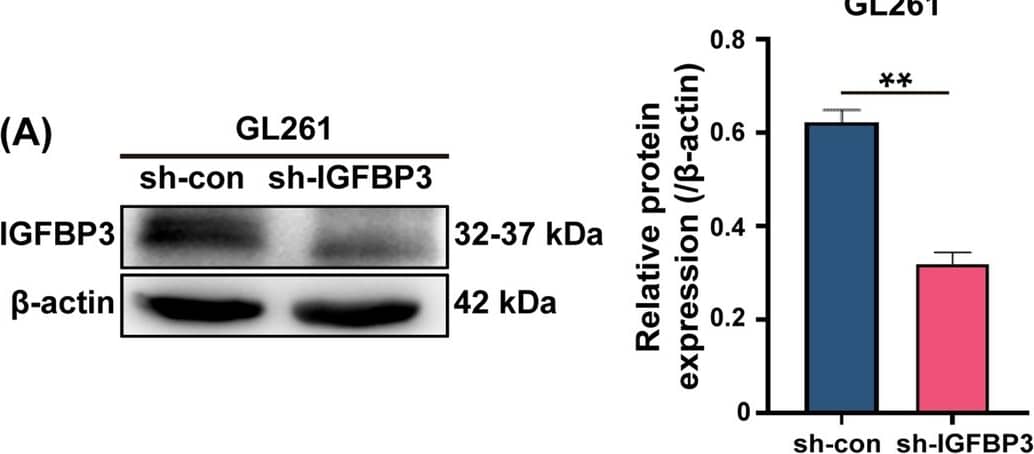 Targeting IGFBP3 therapy efficiently suppresses glioblastoma invasion in vitro and tumor growth in vivo via reducing PD-L1 expression. A Immunoblotting analysis of IGFBP3 expression in GL261 cell infected with sh-IGFBP3 and sh-con. B Immunofluorescence was used to examine IGFBP3 expression in GL261 cell infected with sh-IGFBP3 and sh-con. C Left: Representative image of brain orthotopic tumor. Right: HE stained representative image of brain tumor section. D Kaplan–Meier plots for GL261-shcon and GL261-shIGFBP3 groups, and statistical significance was assessed using the log-rank test. E Immunohistochemical representative images of IGFBP3, PD-L1 and CD31 in the GL261-shcon and GL261-shIGFBP3 groups. F IGFBP3 up-regulates the expression of PD-L1 by activating JAK2/STAT3 signaling pathway. PD-L1 binds to T cell–derived PD-1 to promote T cell apoptosis and immunosuppression. Data are expressed as mean ± SD. **P < 0.01; ***P < 0.001, Student t test Image collected and cropped by CiteAb from the following open publication (//cancerci.biomedcentral.com/articles/10.1186/s12935-024-03234-3), licensed under a CC-BY license. Not internally tested by R&D Systems.