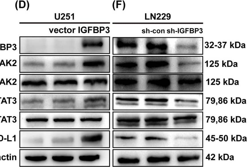 IGFBP3 increases PD-L1 expression by up-regulating the phosphorylation of STAT3 in GBM cells. A KEGG analysis of differential genes. B Correlation analysis of IGFBP3 and STAT3 in TCGA and CGGA databases, and statistical significance was assessed using the spearman’s rank test. C Immunoblotting analysis of IGFBP3, p-JAK2, p-STAT3, and PD-L1 expression in U251 cell treated with different concentrations of IGFBP3 for 24 h. D Immunoblotting analysis of IGFBP3, p-JAK2, p-STAT3, and PD-L1 expression in U251 cells infected with IGFBP3 overexpressing and empty vector lentivirus. E Immunoblotting was performed to examine the expression of IGFBP3, p-JAK2, p-STAT3, and PD-L1 in LN229 cell transfected with si-IGFBP3 and si-NC. F Immunoblotting analysis of IGFBP3, p-JAK2, p-STAT3, and PD-L1 expression in LN229 cell infected with sh-IGFBP3 and sh-con. G LN229 and T98G cells with IGFBP3 knockdown were treated with the JAK2/STAT3 inhibitor WP1066 for 24 h, cell lysate was used to analyze the expression of p-JAK2, p-STAT3 and PD-L1. H Immunoblotting was used to analyze the expression of IGFBP3, p-STAT3, and PD-L1 in STAT3-silenced LN229 and T98G cells stimulated with different concentrations of exogenous IGFBP3 for 24 h Image collected and cropped by CiteAb from the following open publication (//cancerci.biomedcentral.com/articles/10.1186/s12935-024-03234-3), licensed under a CC-BY license. Not internally tested by R&D Systems.