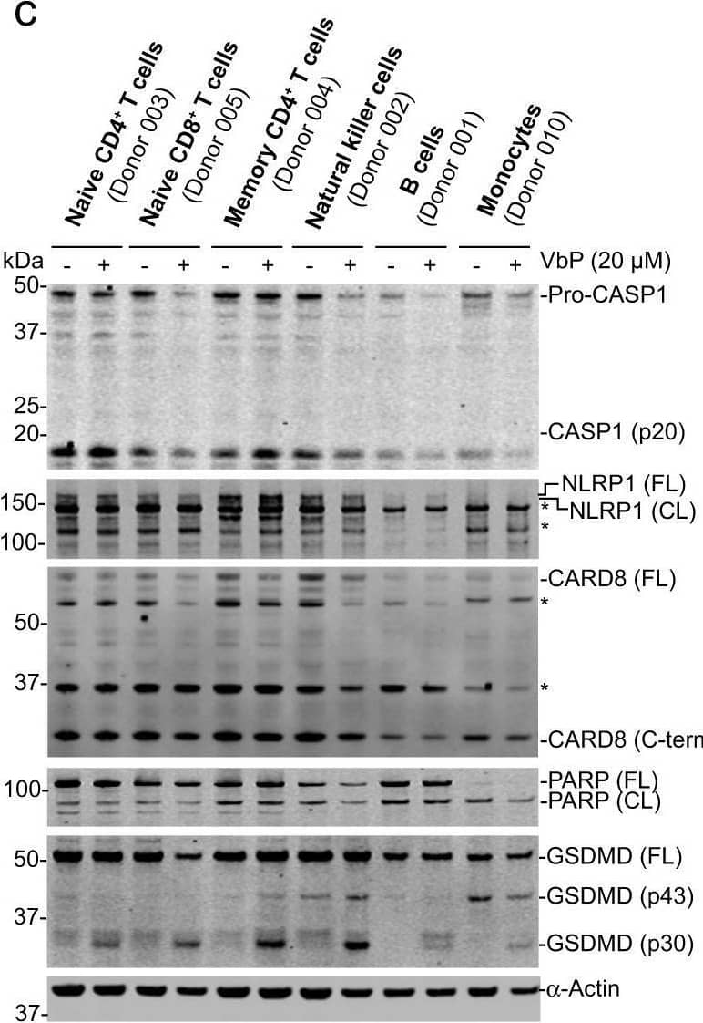 Western Blot NLRP1/NALP1 Antibody [Unconjugated]