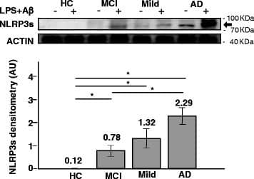 NLRP3s expression in Monocyte by Western blot: NLRP3s protein expression assessed by western blotting in monocyte of individuals with a diagnosis of either severe Alzheimer’s disease (AD), moderate Alzheimer’s disease (MILD) or Mild Cognitive Impairment (MCI) and of age- and sex-matched Healthy Controls (HC). The same protein concentration of whole-cells lysates was loaded into the gel, as confirmed by actin. Representative results obtained in un-stimulated or in LPS-primed and A beta 42-stimulated monocytes are presented in the upper panel. Quantitative evaluation (arbitrary unit, AU) of NLRP3s expression obtained comparing band density (normalized to actin) in un-stimulated or in LPS-primed A beta 42-stimulated monocytes is shown in the lower panel. (N = 5, mean ± s.e.m., T test, *p <0.05). (N = 5/group, mean ± S.E.M and statistical significance are shown. *(p <0.05) Image collected and cropped by CiteAb from the following open publication (//pubmed.ncbi.nlm.nih.gov/26939933), licensed under a CC-BY license. Not internally tested by R&D Systems.