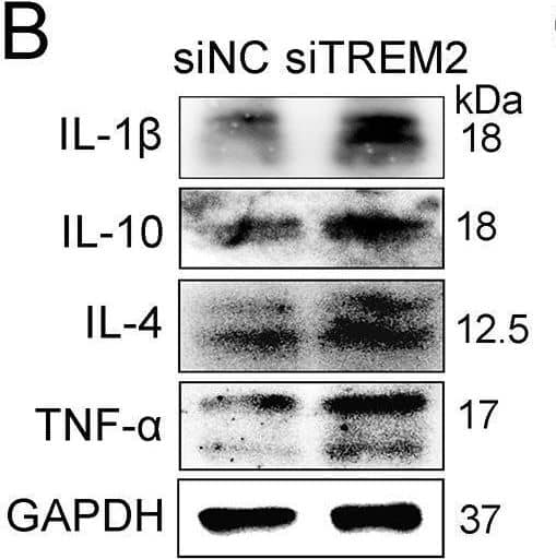 Silencing of TREM2 increases the production of inflammatory cytokines and type I interferons.(A) PAMs were transfected with siNC or siTREM2-1 for 24 h, gene expression of IL-1 beta , IL-6, IL-8, TNF-alpha , IFN-alpha , and IFN-beta  are shown using qRT-PCR. (B) Protein expression of IL-1 beta , IL-10, IL-4, and TNF-alpha  are shown, as detected by western blot analysis in the TREM2 knockdown assay. GAPDH is shown as an internal control. (C) PAMs were transfected with siNC or siTREM2-1 for 24 h and infected with PPRSV (MOI = 1). Cells were collected at the indicated periods. Proinflammatory cytokine (IL-1 beta , IL-6, and IL-8) and type I interferons (IFN-alpha  and IFN-beta ) mRNA expression is shown, as detected by qRT-PCR. (D) PAMs were treated as described in A and infected with PRRSV at different MOIs (0.5 or 1), transcription of IL-1 beta , TNF-alpha , and IFN-beta  is shown, as measured by qRT-PCR. Data are representative of the results of three independent experiments (mean ± SE). Significant differences compared to the control group are denoted by * (P <.05), ** (P <.01) and *** (P <.001). Image collected and cropped by CiteAb from the following open publication (//pubmed.ncbi.nlm.nih.gov/32401783), licensed under a CC-BY license. Not internally tested by R&D Systems.