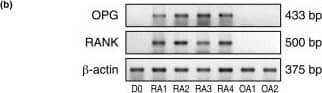 Induction of the expression of RANK-L, OPG, and RANK by normal human blood neutrophils incubated in the presence of synovial fluid (SF) from patients with rheumatoid arthritis (RA) or patients with osteoarthritis (OA). (a) Surface expression of RANK-L by normal blood neutrophils incubated in SF from patients with RA (RA-SF) or OA (OA-SF) for 2 days. Flow cytometry was performed after incubation of neutrophils with a goat anti-human RANK-L antibody followed by a fluorescein isothiocyanate (FITC)-conjugated anti-goat F(ab')2 antibody. Control isotype antibody was a normal goat immunoglobulin G (IgG). Results shown are representative of three RA-SF and nine OA-SF. (b) Expression of mRNA for OPG and RANK by normal blood neutrophils incubated for 2 days in SF from four patients with RA and two patients with OA. Total RNA was isolated from freshly isolated normal blood neutrophils (D0) and from neutrophils of the same healthy donors after 2 days of incubation in SF (RA-1 to -4, OA-1, -2). RNA was then analyzed by reverse transcriptase-polymerase chain reaction. Results shown are representative of two different healthy donors. (c) Surface expression of RANK by normal blood neutrophils incubated in SF from patients with RA (RA-SF) or OA (OA-SF) for 3 days. Flow cytometry was performed after cellular fixation, permeabilization, and staining with a mouse monoclonal anti-human RANK antibody followed by a FITC-conjugated anti-mouse F(ab')2 antibody. Control isotype antibody was a non-specific mouse IgG. Results shown are representative of neutrophils from two different healthy subjects incubated in three different RA-SF and two OA-SF. OPG, osteoprotegerin; RANK, receptor activator of nuclear factor-kappa-B; RANK-L, ligand of receptor activator of nuclear factor-kappa-B. Image collected and cropped by CiteAb from the following open publication (//pubmed.ncbi.nlm.nih.gov/17341304), licensed under a CC-BY license. Not internally tested by R&D Systems.