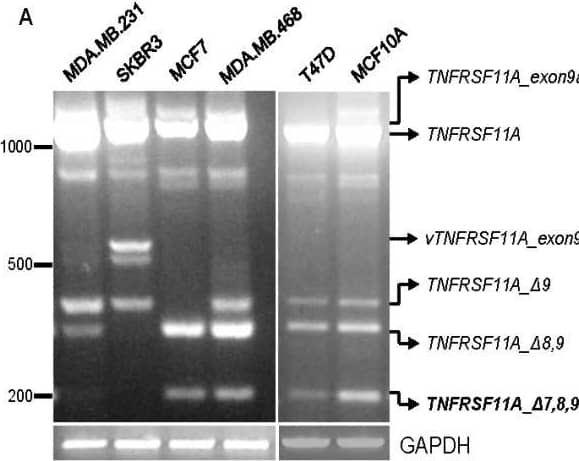 Expression of mRNA encoding tumor necrosis factor receptor superfamily, member 11a (TNFRSF11A, wild type receptor activator of NF-kB, wt RANK), TNFRSF11A_ delta 9 (RANK-a), TNFRSF11A_ delta 8,9 (RANK-b) and TNFRSF11A_ delta 7,8,9 (RANK-c) in breast cancer cell lines and breast cancer samples. A. Agarose gel electrophoresis (2%) of PCR products using primers P1 and P2 depicting TNFRSF11A and the identified alternative splice variants in MDA-MB-231, SKBR3, MCF7, MDA-MB-468, T47D and MCF10A breast cancer cell lines. vTNFRSF11A_exon9a was observed only in SKBR3 and after cloning and sequencing was identified as a TNFRSF11A variant encompassing exons 6, 7, 8, 9a and 10. Splice variant TNFRSF11A_ delta 7,8,9 is in bold. B. TNFRSF11A_ delta 7,8,9 (RANK-c) relative mRNA expression levels in a panel of breast cancer cell lines and the non-tumorigenic epithelial cell line MCF10A; values obtained for MCF10A were set to 100. C. Relative mRNA expression levels of variant TNFRSF11A_ delta 7,8,9 (RANK-c) in a panel of formaldehyde-fixed paraffin embedded (FFPE) invasive ductal breast carcinoma samples analyzed against tumor histological grade and proliferation index Ki-67, respectively. D. Relative mRNA expression levels of TNFRSF11A (wt RANK) in the same panel of invasive ductal breast carcinoma samples plotted against tumor histological grade. Image collected and cropped by CiteAb from the following open publication (//pubmed.ncbi.nlm.nih.gov/22824341), licensed under a CC-BY license. Not internally tested by R&D Systems.