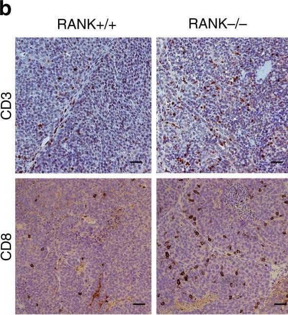 RANK loss in tumor cells leads to increased CD8+ Tcell tumor infiltration that mediates the delayed tumor latency of RANK−/− tumors. Representative images (b)  of CD3+ (n = 4 tumors, ***p = 0.0009) and CD8+ cells (n = 6 tumors, ***p = 0.0001) in RANK+/+ and RANK−/− tumor transplants as assessed by IHC. Scale = 25 μm. Tumors derived from three independent primary tumors were used. Each dot represents one picture#. Image collected and cropped by CiteAb from the following open publication (//pubmed.ncbi.nlm.nih.gov/33303745), licensed under a CC-BY license. Not internally tested by R&D Systems.
