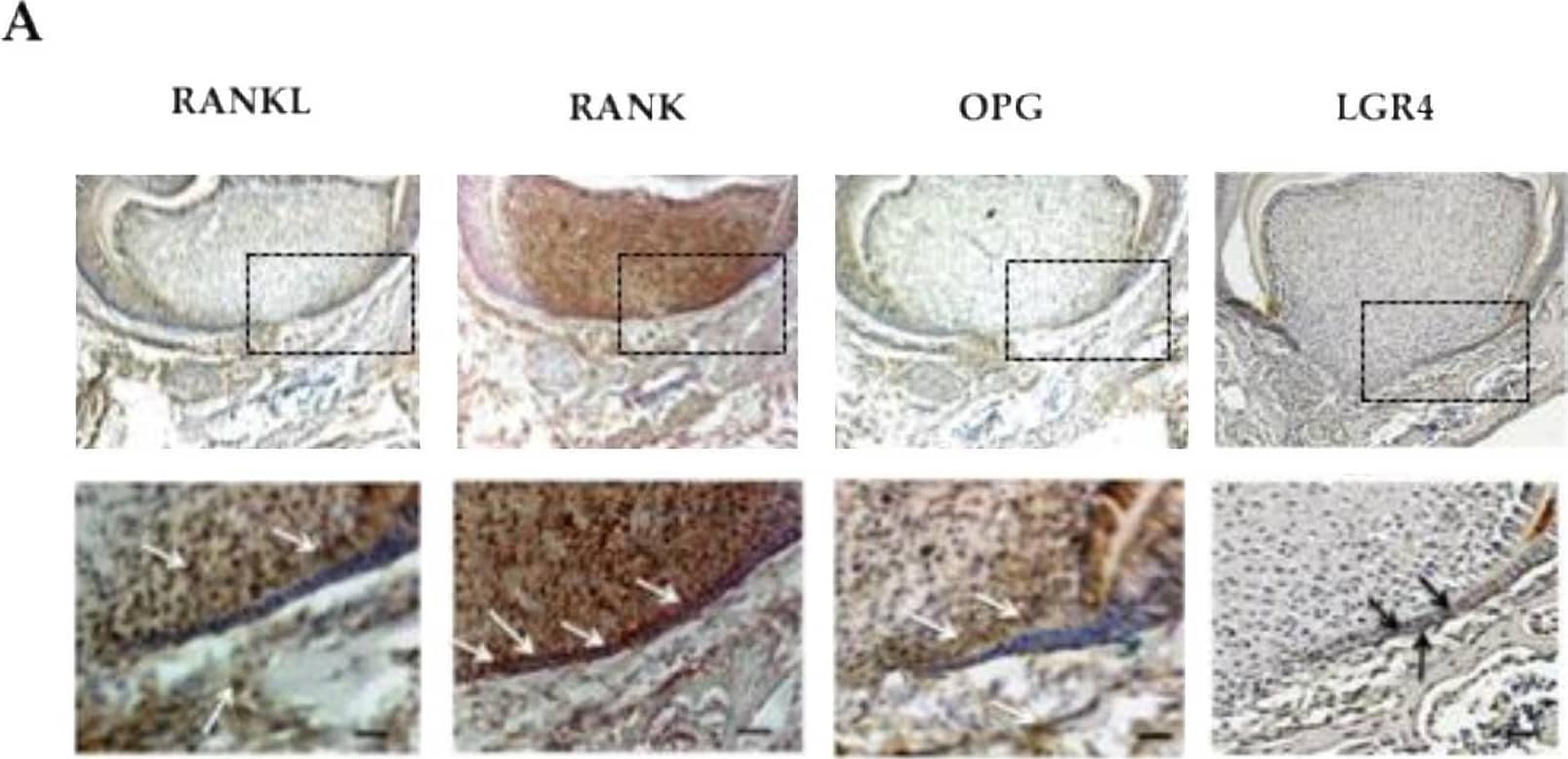 RANKL, RANK, OPG and LGR4 expression patterns in the mandible first molar of 5-day-old wild-type mice. (A) Immunohistochemistry experiments were carried out on 5-µm-thick frontal sections of 5-day-old wild-type C57BL/6 mouse heads for RANKL, RANK, OPG and LGR4. RANKL and OPG expressions were observed in some mesenchymal cells in the pulp, mainly facing Hertwig’s epithelial root sheath, in mesenchymal cells in the apical papilla, and in certain alveolar bone cells (arrowheads). RANK expression was high in the pulp, in Hertwig’s epithelial root sheath and in the cells at the bone surface. Mild LGR4 expression was evidenced in some cells in Hertwig’s epithelial root sheath and the apical papilla (arrowheads), and in most cells at the alveolar bone surface. Scale: 20X/100 µm. (B) Schematic representations of established RANKL, RANK, OPG and LGR4 expression patterns in 5-day-old wild-type C57BL/6 mice mandibular first molar roots. The cells in Hertwig’s epithelial root sheath expressed only RANK and LGR4, with a significant difference in the number of stained cells and the staining intensity in favor of RANK. DE: dental epithelium; E: enamel; D: dentin; P: pulp; HERS: Hertwig’s epithelial root sheath. Image collected and cropped by CiteAb from the following open publication (//pubmed.ncbi.nlm.nih.gov/32209985), licensed under a CC-BY license. Not internally tested by R&D Systems.