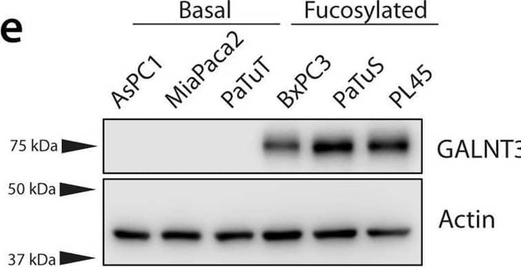 Western Blot Polypeptide GalNac Transferase 3/GALNT3 Antibody