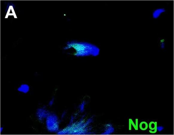 Myo/Nog cells contain ink in human tattooed skin.Tissue sections of tattooed skin were double labeled with the G8 mAb and antibodies to Noggin (Nog) (A-D), MyoD (F-I) or  alpha -SMA (K-N). The colors of the secondary antibodies are indicated in the photographs. Nuclei were stained with Hoechst dye (blue). Images were produced with the epifluorescence (A-E, J and O) and confocal microscopes (F-I and K-N) with 60x lenses. Overlap of green and red fluorescence appears yellow in merged images (C, D, H, I, M and N). Fluorescent photomicrographs were merged with the corresponding DIC image to visualize the ink (black in D, I and N). Some double labeled cells appeared to contain ink (arrows in D, I and N). All ink laden G8+ cells were  alpha -SMA+ (N). Smooth muscle cells of blood vessels also contained  alpha -SMA (K). Minimal to no background fluorescence was visible after staining with the anti-goat (E), anti-IgM and anti-IgG (I), and anti-rabbit (O) secondary antibodies only. Bar = 28 μM in E and 5.6 μM in A-D and G-O. Image collected and cropped by CiteAb from the following open publication (//pubmed.ncbi.nlm.nih.gov/32833999), licensed under a CC-BY license. Not internally tested by R&D Systems.