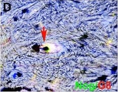 Myo/Nog cells contain ink in human tattooed skin.Tissue sections of tattooed skin were double labeled with the G8 mAb and antibodies to Noggin (Nog) (A-D), MyoD (F-I) or  alpha -SMA (K-N). The colors of the secondary antibodies are indicated in the photographs. Nuclei were stained with Hoechst dye (blue). Images were produced with the epifluorescence (A-E, J and O) and confocal microscopes (F-I and K-N) with 60x lenses. Overlap of green and red fluorescence appears yellow in merged images (C, D, H, I, M and N). Fluorescent photomicrographs were merged with the corresponding DIC image to visualize the ink (black in D, I and N). Some double labeled cells appeared to contain ink (arrows in D, I and N). All ink laden G8+ cells were  alpha -SMA+ (N). Smooth muscle cells of blood vessels also contained  alpha -SMA (K). Minimal to no background fluorescence was visible after staining with the anti-goat (E), anti-IgM and anti-IgG (I), and anti-rabbit (O) secondary antibodies only. Bar = 28 μM in E and 5.6 μM in A-D and G-O. Image collected and cropped by CiteAb from the following open publication (//pubmed.ncbi.nlm.nih.gov/32833999), licensed under a CC-BY license. Not internally tested by R&D Systems.