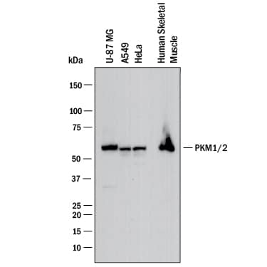 Western blot shows lysates of U‑87 MG human glioblastoma/astrocytoma cell line, A549 human lung carcinoma cell line, HeLa human cervical epithelial carcinoma cell line, human skeletal muscle. PVDF membrane was probed with 0.25 µg/mL of Sheep Anti-Human/Mouse/Rat PKM2 Antigen Affinity-purified Polyclonal Antibody (Catalog # AF7244) followed by HRP-conjugated Anti-Sheep IgG Secondary Antibody (HAF016). A specific band was detected for PKM2 at approximately 60 kDa (as indicated). This experiment was conducted under reducing conditions and using Western Blot Buffer Group 1.