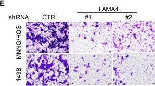 Knockdown of LAMA4 suppresses the malignant behaviour of osteosarcoma and accelerates ER stress-induced apoptosis. A The expression levels of LAMA4 in osteosarcoma (n = 88) and normal tissues (n = 564) were analysed from the TNMplot database. B LAMA4 was knocked down in MNNG/HOS and 143B cells. The expression of LAMA4 was detected by Western blot. GAPDH was used as the loading control. C-D The cells (3000 cells/well) with or without LAMA4 depletion were tested for cell growth in the colony formation assay. Viable colonies after 1 week were counted and are shown (C). Data are depicted as bar graphs (D). E-F The migration of the indicated cells was detected by Transwell assays. Representative images of crystal violet-stained culture plates are shown (E). Data are depicted as bar graphs (F). G-H MNNG/HOS cells with or without LAMA4 knockdown were treated with 3 μM TM for 36 h. Cell apoptosis and cell viability were analysed by Western blot (G) and CCK8 assays (H). GAPDH was used as the loading control. I-J MNNG/HOS cells with or without LAMA4 knockdown were treated with 1 μM TG for 36 h. Cell apoptosis and cell viability were analysed by Western blot (I) and CCK8 assays (J). GAPDH was used as the loading control. K-M MNNG/HOS cells (106 cells per mouse) with or without LAMA4 knockdown were injected subcutaneously into nude mice (n = 4). Representative images of xenograft tumours (K). The weights of the tumours were calculated and analysed (L). The expression levels of PARP, cleaved PARP and LAMA4 in tumours were measured by Western blot (M). Data in D, F, H, J, L were analysed by Student’s t test, *p < 0.05, **p < 0.01, ***p < 0.001 Image collected and cropped by CiteAb from the following open publication (//pubmed.ncbi.nlm.nih.gov/36539799), licensed under a CC-BY license. Not internally tested by R&D Systems.