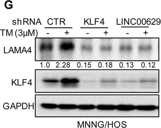KLF4 upregulates LAMA4 expression. A-B Heatmap showing the altered genes identified by RNA sequencing analysis in LINC00629 (A)- or KLF4 (B)-depleted MNNG/HOS cells. C Volcano plots showing differentially expressed mRNAs for LINC00629 knockdown or KLF4 knockdown versus the controls (absolute log2-fold change > 1 and q value < 0.05). The green dot indicates the downregulated genes, and the red dot indicates the upregulated genes. D The mRNA levels of LAMA4 are shown from RNA sequencing data. E-F The protein and mRNA levels of LAMA4 were detected by Western blot (E) and qRT–PCR (F) in MNNG/HOS cells with or without LINC00629 or KLF4 knockdown. Numbers represent the relative intensities of western blot bands of LAMA4 to GAPDH. G MNNG/HOS cells with or without KLF4 or LINC00629 knockdown were treated with 3 μM TM for 36 h. The expression of LAMA4 was detected by Western blot. Numbers represent the relative intensities of western blot bands of LAMA4 to GAPDH. H-I LINC00629 was overexpressed in MNNG/HOS cells with or without KLF4 knockdown. The protein and mRNA levels of LAMA4 were detected by Western blotting (H) and qRT–PCR (I). Numbers represent the relative intensities of western blot bands of LAMA4 to GAPDH. Data in F and M were analysed by Student’s t test, *p < 0.05, **p < 0.01, ***p < 0.001 Image collected and cropped by CiteAb from the following open publication (//pubmed.ncbi.nlm.nih.gov/36539799), licensed under a CC-BY license. Not internally tested by R&D Systems.
