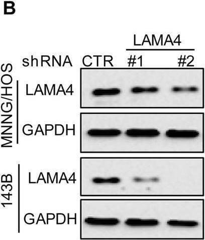Knockdown of LAMA4 suppresses the malignant behaviour of osteosarcoma and accelerates ER stress-induced apoptosis. A The expression levels of LAMA4 in osteosarcoma (n = 88) and normal tissues (n = 564) were analysed from the TNMplot database. B LAMA4 was knocked down in MNNG/HOS and 143B cells. The expression of LAMA4 was detected by Western blot. GAPDH was used as the loading control. C-D The cells (3000 cells/well) with or without LAMA4 depletion were tested for cell growth in the colony formation assay. Viable colonies after 1 week were counted and are shown (C). Data are depicted as bar graphs (D). E-F The migration of the indicated cells was detected by Transwell assays. Representative images of crystal violet-stained culture plates are shown (E). Data are depicted as bar graphs (F). G-H MNNG/HOS cells with or without LAMA4 knockdown were treated with 3 μM TM for 36 h. Cell apoptosis and cell viability were analysed by Western blot (G) and CCK8 assays (H). GAPDH was used as the loading control. I-J MNNG/HOS cells with or without LAMA4 knockdown were treated with 1 μM TG for 36 h. Cell apoptosis and cell viability were analysed by Western blot (I) and CCK8 assays (J). GAPDH was used as the loading control. K-M MNNG/HOS cells (106 cells per mouse) with or without LAMA4 knockdown were injected subcutaneously into nude mice (n = 4). Representative images of xenograft tumours (K). The weights of the tumours were calculated and analysed (L). The expression levels of PARP, cleaved PARP and LAMA4 in tumours were measured by Western blot (M). Data in D, F, H, J, L were analysed by Student’s t test, *p < 0.05, **p < 0.01, ***p < 0.001 Image collected and cropped by CiteAb from the following open publication (//pubmed.ncbi.nlm.nih.gov/36539799), licensed under a CC-BY license. Not internally tested by R&D Systems.