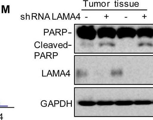 Knockdown of LAMA4 suppresses the malignant behaviour of osteosarcoma and accelerates ER stress-induced apoptosis. A The expression levels of LAMA4 in osteosarcoma (n = 88) and normal tissues (n = 564) were analysed from the TNMplot database. B LAMA4 was knocked down in MNNG/HOS and 143B cells. The expression of LAMA4 was detected by Western blot. GAPDH was used as the loading control. C-D The cells (3000 cells/well) with or without LAMA4 depletion were tested for cell growth in the colony formation assay. Viable colonies after 1 week were counted and are shown (C). Data are depicted as bar graphs (D). E-F The migration of the indicated cells was detected by Transwell assays. Representative images of crystal violet-stained culture plates are shown (E). Data are depicted as bar graphs (F). G-H MNNG/HOS cells with or without LAMA4 knockdown were treated with 3 μM TM for 36 h. Cell apoptosis and cell viability were analysed by Western blot (G) and CCK8 assays (H). GAPDH was used as the loading control. I-J MNNG/HOS cells with or without LAMA4 knockdown were treated with 1 μM TG for 36 h. Cell apoptosis and cell viability were analysed by Western blot (I) and CCK8 assays (J). GAPDH was used as the loading control. K-M MNNG/HOS cells (106 cells per mouse) with or without LAMA4 knockdown were injected subcutaneously into nude mice (n = 4). Representative images of xenograft tumours (K). The weights of the tumours were calculated and analysed (L). The expression levels of PARP, cleaved PARP and LAMA4 in tumours were measured by Western blot (M). Data in D, F, H, J, L were analysed by Student’s t test, *p < 0.05, **p < 0.01, ***p < 0.001 Image collected and cropped by CiteAb from the following open publication (//pubmed.ncbi.nlm.nih.gov/36539799), licensed under a CC-BY license. Not internally tested by R&D Systems.