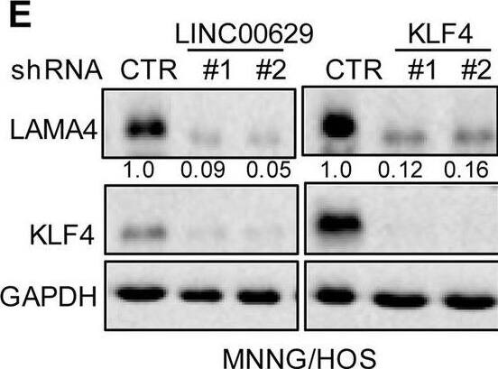 KLF4 upregulates LAMA4 expression. A-B Heatmap showing the altered genes identified by RNA sequencing analysis in LINC00629 (A)- or KLF4 (B)-depleted MNNG/HOS cells. C Volcano plots showing differentially expressed mRNAs for LINC00629 knockdown or KLF4 knockdown versus the controls (absolute log2-fold change > 1 and q value < 0.05). The green dot indicates the downregulated genes, and the red dot indicates the upregulated genes. D The mRNA levels of LAMA4 are shown from RNA sequencing data. E-F The protein and mRNA levels of LAMA4 were detected by Western blot (E) and qRT–PCR (F) in MNNG/HOS cells with or without LINC00629 or KLF4 knockdown. Numbers represent the relative intensities of western blot bands of LAMA4 to GAPDH. G MNNG/HOS cells with or without KLF4 or LINC00629 knockdown were treated with 3 μM TM for 36 h. The expression of LAMA4 was detected by Western blot. Numbers represent the relative intensities of western blot bands of LAMA4 to GAPDH. H-I LINC00629 was overexpressed in MNNG/HOS cells with or without KLF4 knockdown. The protein and mRNA levels of LAMA4 were detected by Western blotting (H) and qRT–PCR (I). Numbers represent the relative intensities of western blot bands of LAMA4 to GAPDH. Data in F and M were analysed by Student’s t test, *p < 0.05, **p < 0.01, ***p < 0.001 Image collected and cropped by CiteAb from the following open publication (//pubmed.ncbi.nlm.nih.gov/36539799), licensed under a CC-BY license. Not internally tested by R&D Systems.