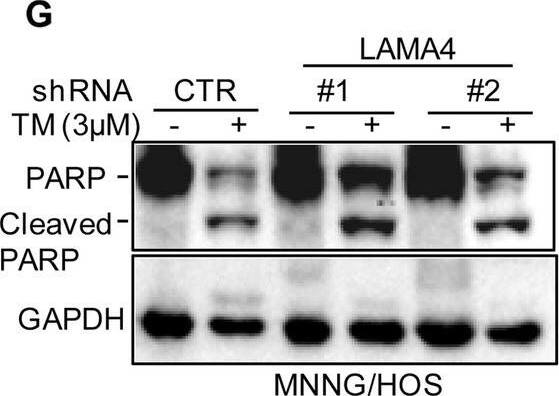 Knockdown of LAMA4 suppresses the malignant behaviour of osteosarcoma and accelerates ER stress-induced apoptosis. A The expression levels of LAMA4 in osteosarcoma (n = 88) and normal tissues (n = 564) were analysed from the TNMplot database. B LAMA4 was knocked down in MNNG/HOS and 143B cells. The expression of LAMA4 was detected by Western blot. GAPDH was used as the loading control. C-D The cells (3000 cells/well) with or without LAMA4 depletion were tested for cell growth in the colony formation assay. Viable colonies after 1 week were counted and are shown (C). Data are depicted as bar graphs (D). E-F The migration of the indicated cells was detected by Transwell assays. Representative images of crystal violet-stained culture plates are shown (E). Data are depicted as bar graphs (F). G-H MNNG/HOS cells with or without LAMA4 knockdown were treated with 3 μM TM for 36 h. Cell apoptosis and cell viability were analysed by Western blot (G) and CCK8 assays (H). GAPDH was used as the loading control. I-J MNNG/HOS cells with or without LAMA4 knockdown were treated with 1 μM TG for 36 h. Cell apoptosis and cell viability were analysed by Western blot (I) and CCK8 assays (J). GAPDH was used as the loading control. K-M MNNG/HOS cells (106 cells per mouse) with or without LAMA4 knockdown were injected subcutaneously into nude mice (n = 4). Representative images of xenograft tumours (K). The weights of the tumours were calculated and analysed (L). The expression levels of PARP, cleaved PARP and LAMA4 in tumours were measured by Western blot (M). Data in D, F, H, J, L were analysed by Student’s t test, *p < 0.05, **p < 0.01, ***p < 0.001 Image collected and cropped by CiteAb from the following open publication (//pubmed.ncbi.nlm.nih.gov/36539799), licensed under a CC-BY license. Not internally tested by R&D Systems.