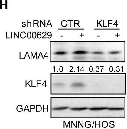 KLF4 upregulates LAMA4 expression. A-B Heatmap showing the altered genes identified by RNA sequencing analysis in LINC00629 (A)- or KLF4 (B)-depleted MNNG/HOS cells. C Volcano plots showing differentially expressed mRNAs for LINC00629 knockdown or KLF4 knockdown versus the controls (absolute log2-fold change > 1 and q value < 0.05). The green dot indicates the downregulated genes, and the red dot indicates the upregulated genes. D The mRNA levels of LAMA4 are shown from RNA sequencing data. E-F The protein and mRNA levels of LAMA4 were detected by Western blot (E) and qRT–PCR (F) in MNNG/HOS cells with or without LINC00629 or KLF4 knockdown. Numbers represent the relative intensities of western blot bands of LAMA4 to GAPDH. G MNNG/HOS cells with or without KLF4 or LINC00629 knockdown were treated with 3 μM TM for 36 h. The expression of LAMA4 was detected by Western blot. Numbers represent the relative intensities of western blot bands of LAMA4 to GAPDH. H-I LINC00629 was overexpressed in MNNG/HOS cells with or without KLF4 knockdown. The protein and mRNA levels of LAMA4 were detected by Western blotting (H) and qRT–PCR (I). Numbers represent the relative intensities of western blot bands of LAMA4 to GAPDH. Data in F and M were analysed by Student’s t test, *p < 0.05, **p < 0.01, ***p < 0.001 Image collected and cropped by CiteAb from the following open publication (//pubmed.ncbi.nlm.nih.gov/36539799), licensed under a CC-BY license. Not internally tested by R&D Systems.