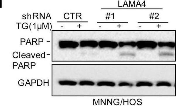 Knockdown of LAMA4 suppresses the malignant behaviour of osteosarcoma and accelerates ER stress-induced apoptosis. A The expression levels of LAMA4 in osteosarcoma (n = 88) and normal tissues (n = 564) were analysed from the TNMplot database. B LAMA4 was knocked down in MNNG/HOS and 143B cells. The expression of LAMA4 was detected by Western blot. GAPDH was used as the loading control. C-D The cells (3000 cells/well) with or without LAMA4 depletion were tested for cell growth in the colony formation assay. Viable colonies after 1 week were counted and are shown (C). Data are depicted as bar graphs (D). E-F The migration of the indicated cells was detected by Transwell assays. Representative images of crystal violet-stained culture plates are shown (E). Data are depicted as bar graphs (F). G-H MNNG/HOS cells with or without LAMA4 knockdown were treated with 3 μM TM for 36 h. Cell apoptosis and cell viability were analysed by Western blot (G) and CCK8 assays (H). GAPDH was used as the loading control. I-J MNNG/HOS cells with or without LAMA4 knockdown were treated with 1 μM TG for 36 h. Cell apoptosis and cell viability were analysed by Western blot (I) and CCK8 assays (J). GAPDH was used as the loading control. K-M MNNG/HOS cells (106 cells per mouse) with or without LAMA4 knockdown were injected subcutaneously into nude mice (n = 4). Representative images of xenograft tumours (K). The weights of the tumours were calculated and analysed (L). The expression levels of PARP, cleaved PARP and LAMA4 in tumours were measured by Western blot (M). Data in D, F, H, J, L were analysed by Student’s t test, *p < 0.05, **p < 0.01, ***p < 0.001 Image collected and cropped by CiteAb from the following open publication (//pubmed.ncbi.nlm.nih.gov/36539799), licensed under a CC-BY license. Not internally tested by R&D Systems.