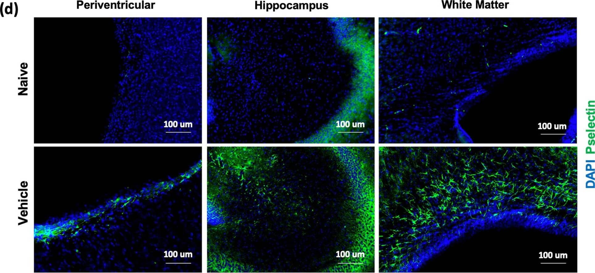 Expression of P-selectin in different brain regions following GMH. P14 brain sections stained for P-selectin (CD62p) and quantified in 3 specific brain regions of each experimental group as indicated (a, b, c). One-way ANOVA with Turkey’s correction for multiple comparisons. ****p < 0.0001. Error bars = mean ± SEM. d 40 × representative images of P-selectin staining (green) and DAPI (blue) within each brain region for naïve and GMH animals Image collected and cropped by CiteAb from the following open publication (//pubmed.ncbi.nlm.nih.gov/37322469), licensed under a CC-BY license. Not internally tested by R&D Systems.