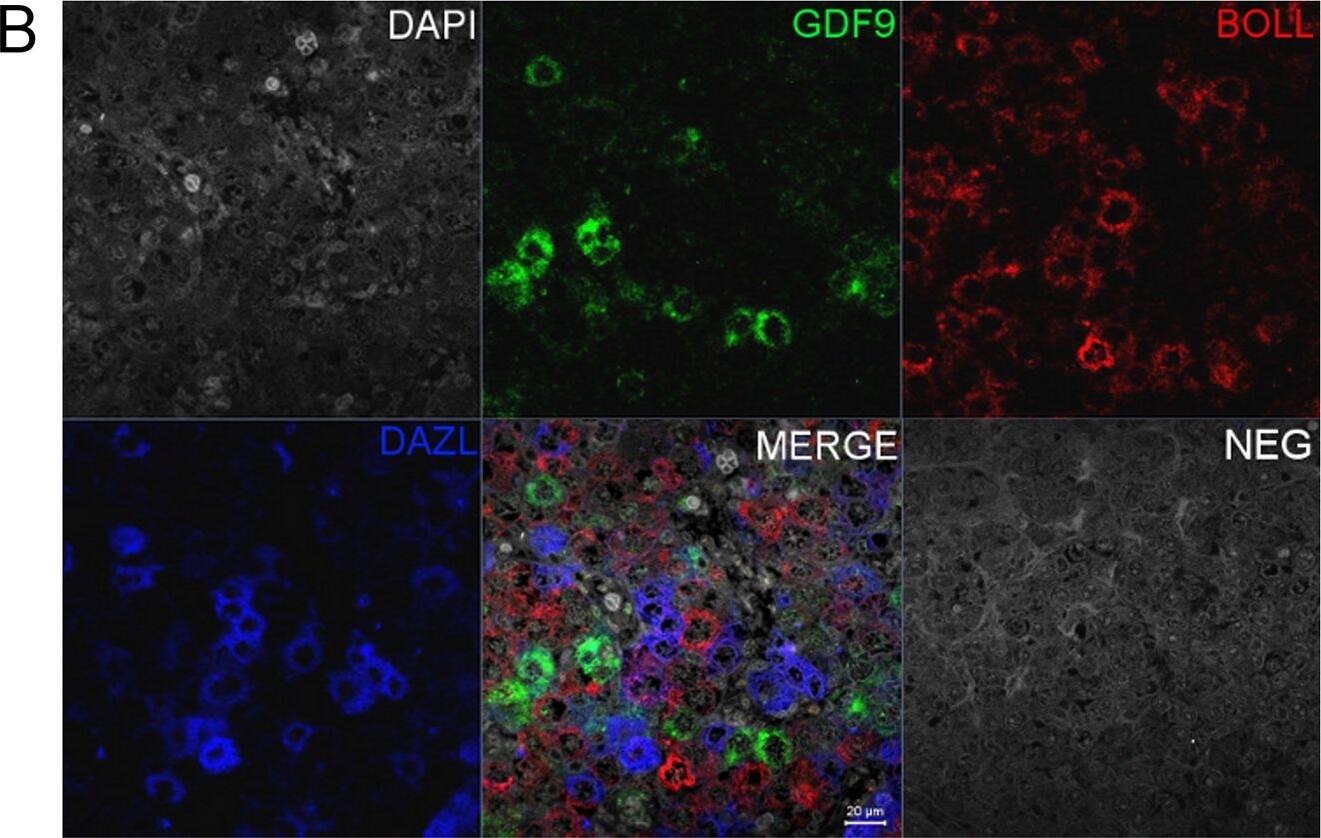 Co-localisation of GDF9 with activin  beta A but not DAZL or BOLL prior to follicle formation.(A) Double immunohistochemistry of 18 week fetal ovary stained for GDF9 (green) and activin  beta A (red), thus in the merged image co-expression is yellow. Unstained germ cells are indicated with arrows. Counterstain is TOPRO. (B) Triple fluorescent immunohistochemistry for GDF9 (green), DAZL (blue) and BOLL (red) in 20 week human fetal ovary with DAPI as counterstain (grey). Split channel and merged images in (A) and (B) are shown as are merged images of non-immune serum negative control (NEG). Scale bars are 20μm. (C) Nuclear diameters of DAZL, BOLL and GDF9 stained germ cells indicates that GDF9 positive cells are significantly larger (p<0.001) than DAZL but not BOLL expressing cells (bars indicate mean ± sem). (D) Higher magnification merged image of GDF9/DAZL/BOLL immunohistochemistry showing one large primordial follicle is positive for both GDF9 and DAZL but other follicles are positive only for DAZL. Image collected and cropped by CiteAb from the following open publication (//pubmed.ncbi.nlm.nih.gov/25790371), licensed under a CC-BY license. Not internally tested by R&D Systems.