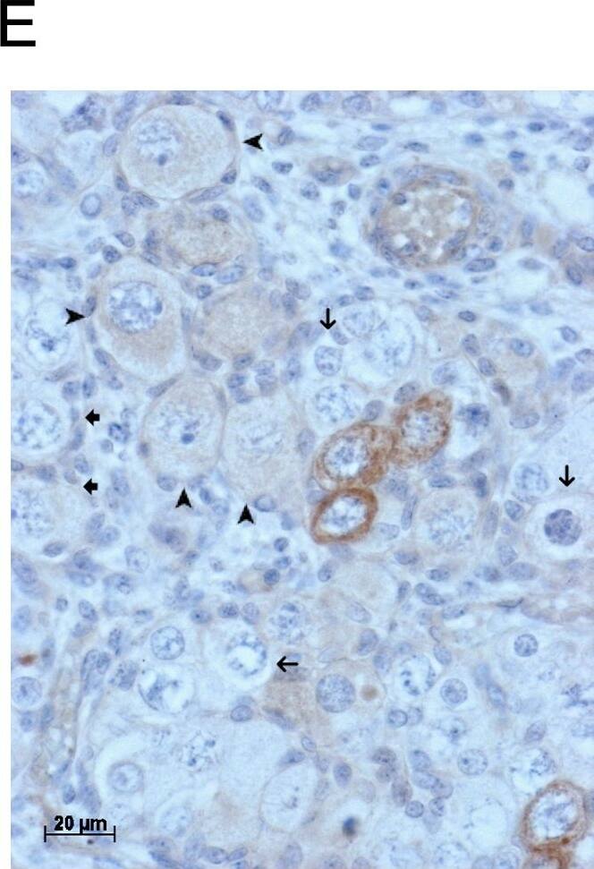 GDF9 is expressed in the human fetal ovary.qRT-PCR analysis of GDF9 (A), BMP15 (B) and NOBOX (C) mRNA expression in human fetal ovary across the gestational range of 8 to 20 weeks. Ovaries (n = 5–7 per group) were grouped according to developmental stage and transcript levels measured relative to those of RPL32. Bars indicate mean±sem. Statistically different levels are indicated by asterisks above the columns, thus expression of GDF9 at 18–20 weeks was significantly higher than at 8–11 weeks (p<0.005) as was expression of BMP15 and of NOBOX (both p<0.01). DAB immunohistochemical detection of GDF9: 19 week (D, E) and 20 week (F) human fetal ovary stained with anti-GDF9 antibody or normal goat IgG negative control (F inset)—positive staining is brown. Thick arrows indicate primordial follicles and thin arrows germ cells that are not stained for GDF9 while the arrowheads indicate primordial follicles that are positive for GDF9. Scale bars are 50μm (D and F) and 20μm (E). Image collected and cropped by CiteAb from the following open publication (//pubmed.ncbi.nlm.nih.gov/25790371), licensed under a CC-BY license. Not internally tested by R&D Systems.