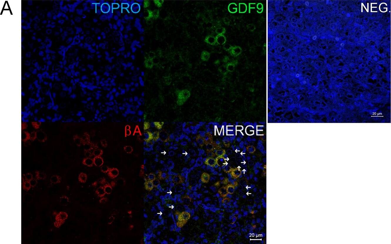 Co-localisation of GDF9 with activin  beta A but not DAZL or BOLL prior to follicle formation.(A) Double immunohistochemistry of 18 week fetal ovary stained for GDF9 (green) and activin  beta A (red), thus in the merged image co-expression is yellow. Unstained germ cells are indicated with arrows. Counterstain is TOPRO. (B) Triple fluorescent immunohistochemistry for GDF9 (green), DAZL (blue) and BOLL (red) in 20 week human fetal ovary with DAPI as counterstain (grey). Split channel and merged images in (A) and (B) are shown as are merged images of non-immune serum negative control (NEG). Scale bars are 20μm. (C) Nuclear diameters of DAZL, BOLL and GDF9 stained germ cells indicates that GDF9 positive cells are significantly larger (p<0.001) than DAZL but not BOLL expressing cells (bars indicate mean ± sem). (D) Higher magnification merged image of GDF9/DAZL/BOLL immunohistochemistry showing one large primordial follicle is positive for both GDF9 and DAZL but other follicles are positive only for DAZL. Image collected and cropped by CiteAb from the following open publication (//pubmed.ncbi.nlm.nih.gov/25790371), licensed under a CC-BY license. Not internally tested by R&D Systems.