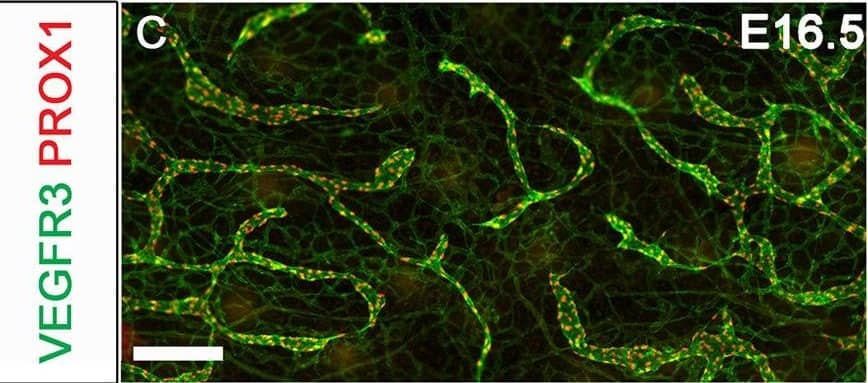 YAP and TAZ are required for the maintenance of LVs. The lymphatic vessels in the dorsal skin of E16.5 and E18.5 control and Lyve1-Cre;Yapf/f;Tazf/f embryos were analyzed by whole-mount immunohistochemistry. (A,B) LVs were observed in the collecting lymphatic vessels of E16.5 control and Lyve1-Cre;Yapf/f;Tazf/f embryos (arrows). (C,D) The migrating front of E16.5 control (C) and Lyve1-Cre;Yapf/f;Tazf/f (D) embryos appeared comparable. (E-G) At E18.5, the lymphatic vessels from the left and right sides have merged to form a network in control embryos (E). In contrast, huge gaps were observed in between the migrating fronts of E18.5 Lyve1-Cre;Yapf/f;Tazf/f embryos (F, magenta lines). The lymphatic vessels of mutant embryos were also dilated. The distance between the migrating fronts and the diameter of vessels are quantified in G. (H,I) LVs were observed in the collecting lymphatic vessels of E18.5 control embryos (H, yellow arrows). In contrast, the dilated lymphatic vessels of E18.5 Lyve1-Cre;Yapf/f;Tazf/f embryos lacked LVs (I). The various parameters of lymphatic vascular patterning were quantified and are plotted in G. n=4 embryos per each genotype. ****P<0.0001. Data are mean±s.e.m. Scale bars: 200 µm in A-D; 500 µm in E,F; 200 µm in H,I. Image collected and cropped by CiteAb from the following publication (//pubmed.ncbi.nlm.nih.gov/33060128), licensed under a CC-BY license. Not internally tested by R&D Systems.